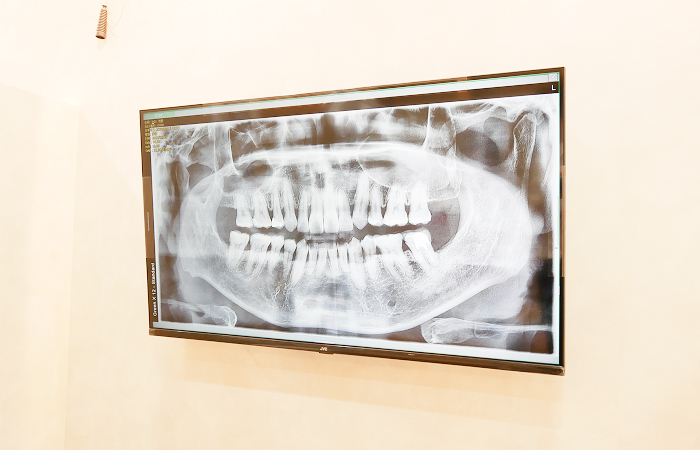 説明用モニター